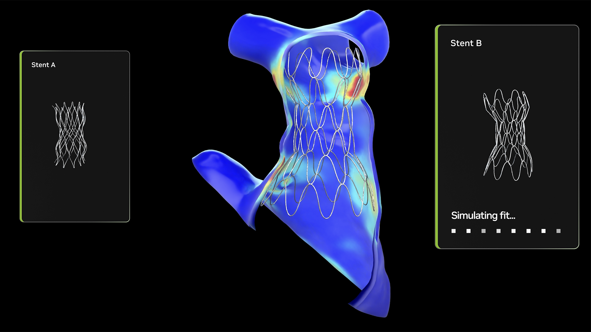 聚焦心脏健康：大型儿童医院将开源 NVIDIA AI 技术用于心脏疾病诊疗